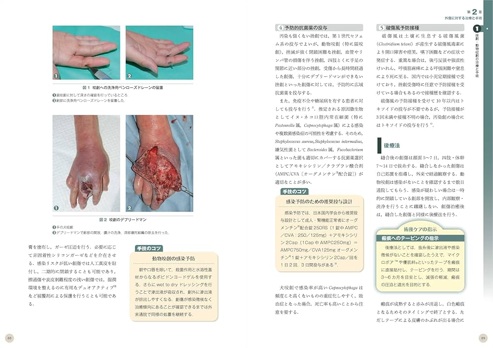 裁断済改訂2版 超入門 形成外科・美容外科手術手技の基本が写真とWEB動画70… 改訂2版 超入門 形成外科・美容外科手術:手技の基本が写真とWEB